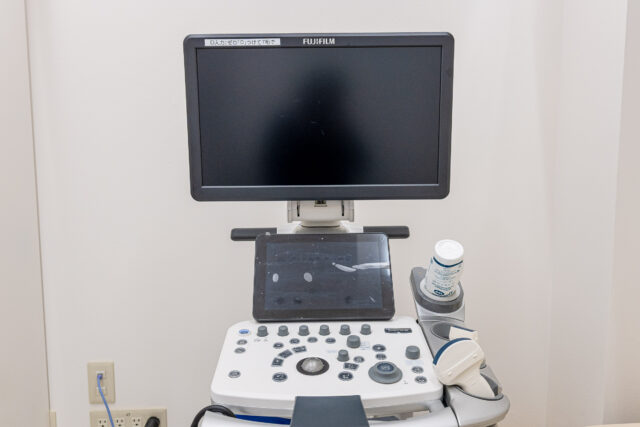 超音波診断装置