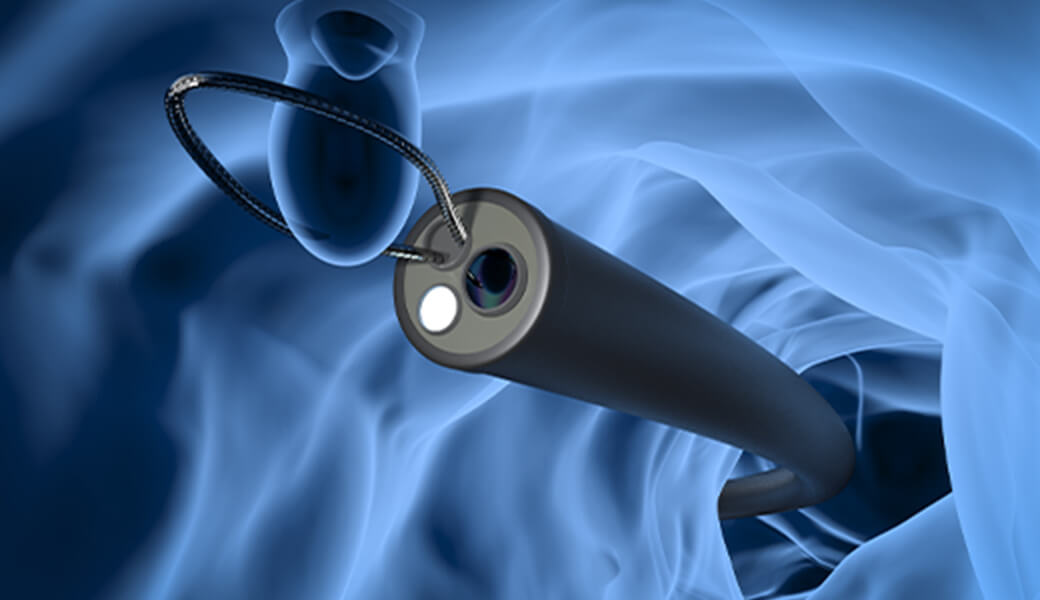 日帰り大腸ポリープの切除が可能